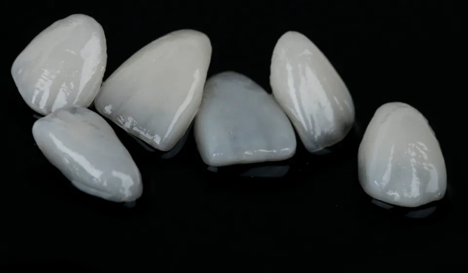 ラミネートベニア