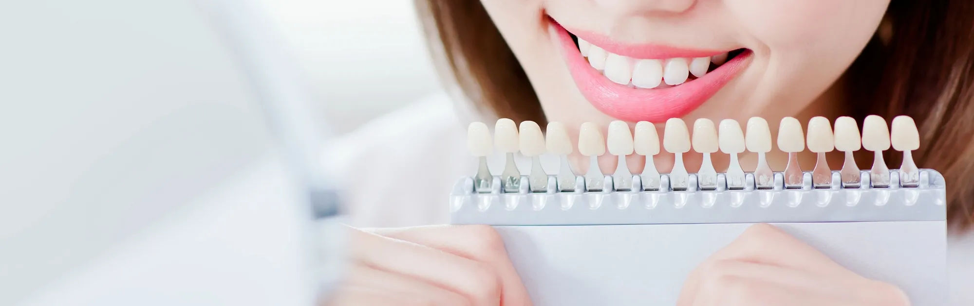 ホワイトニングとは