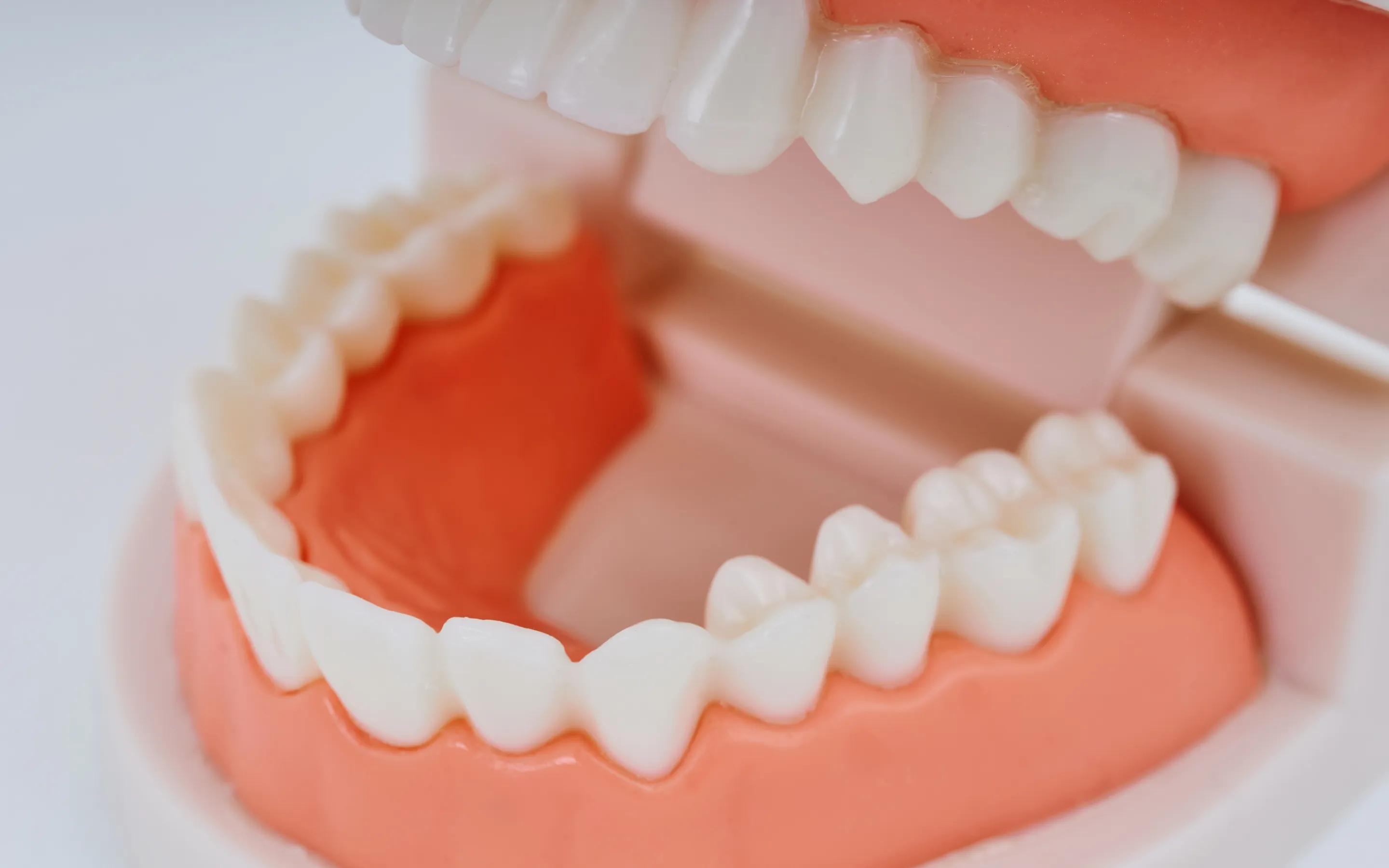 咬み合わせ治療