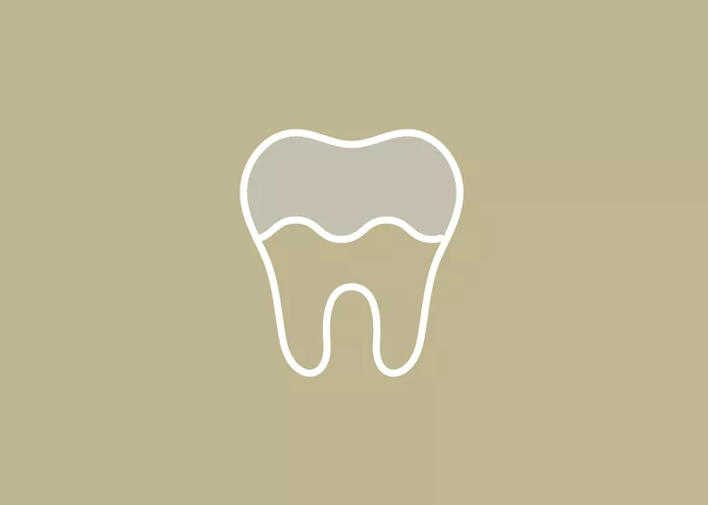 銀歯が気になる