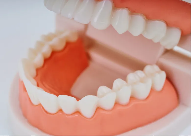 咬み合わせ治療