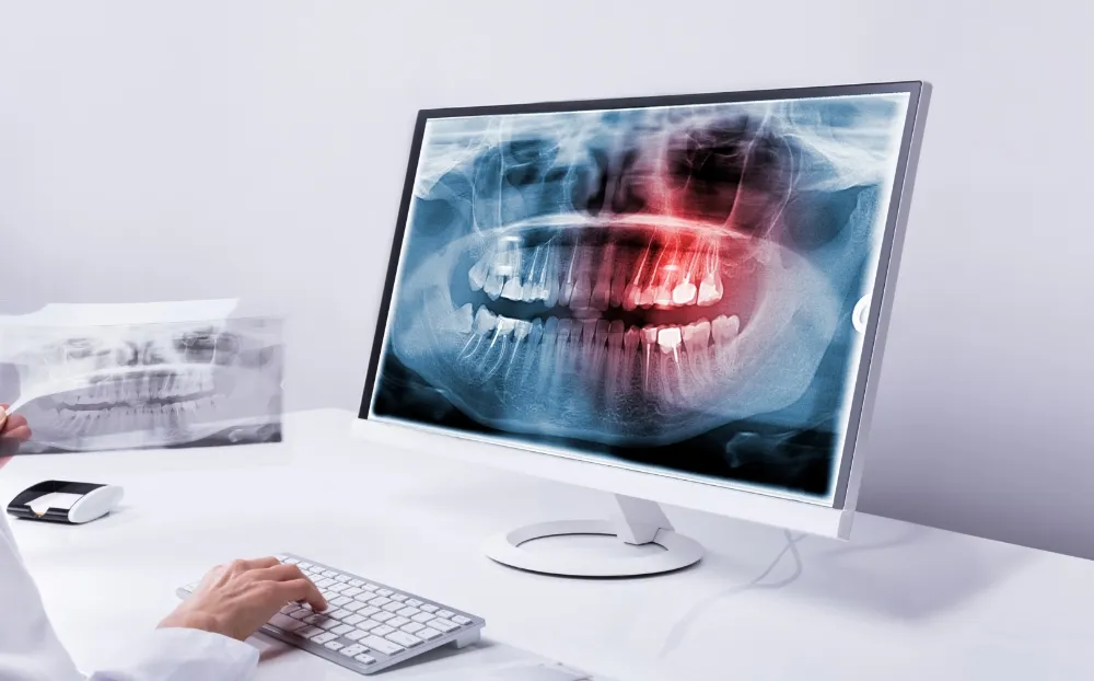 歯を失った原因を究明し、最適な治療法をご提案