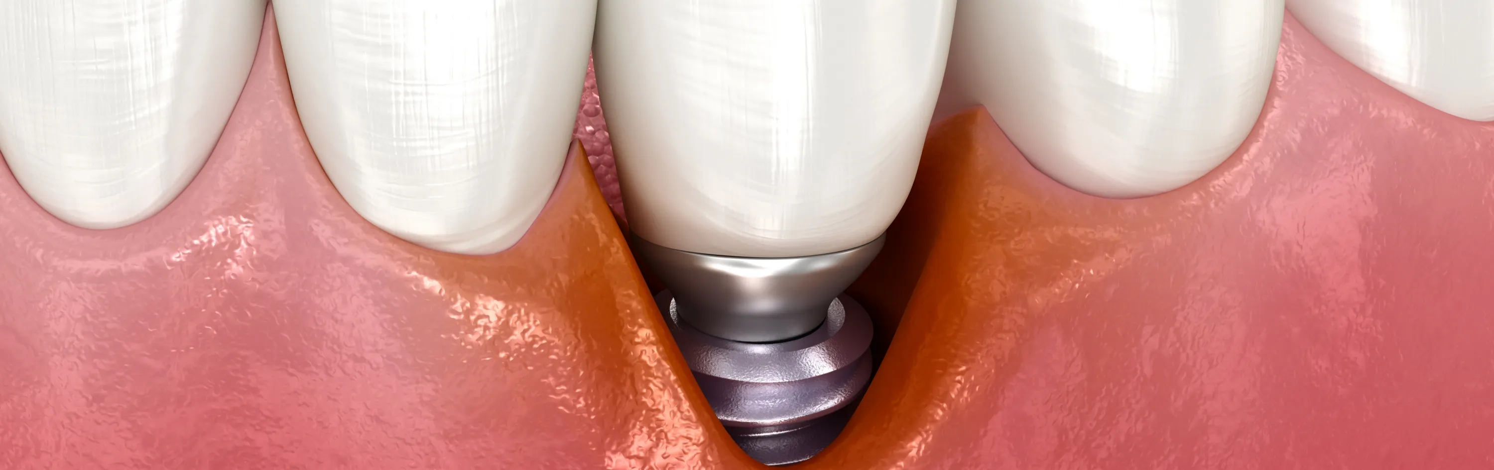 治療後のメンテナンス